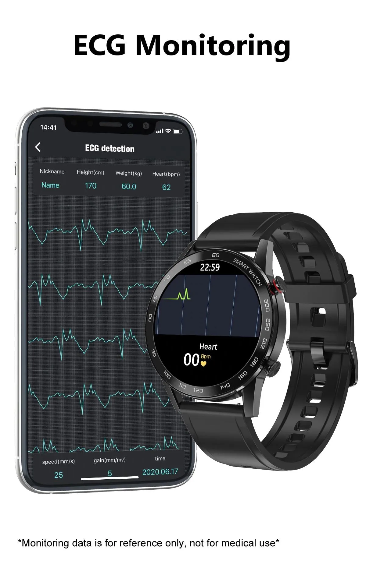 SMAXPLUS RISE™ Men's Smartwatch: Blood/Heart Monitor, Fitness Tracker, Bluetooth Calling