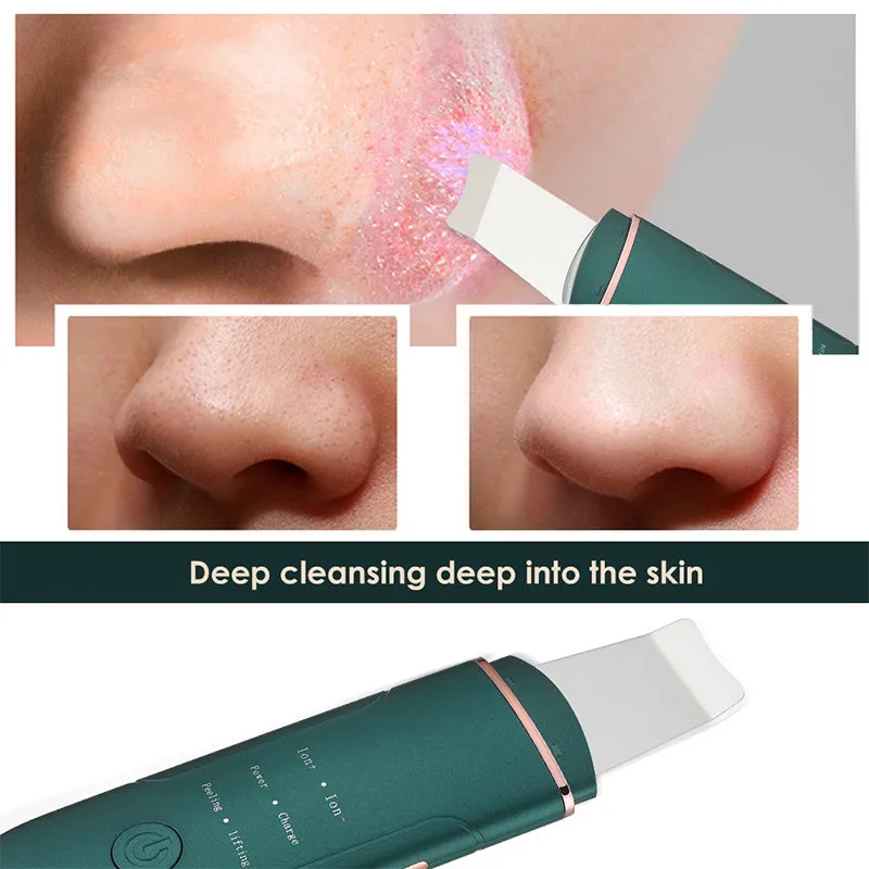 Ultrasonic Cleaning Massager for Face Care Acne Blackheads Remover