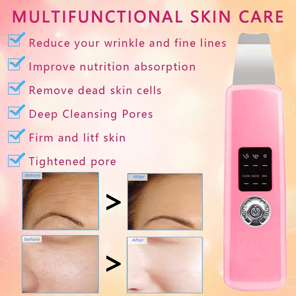 Ultrasonic Skin Scrubber Deep Remove Dirt Blackhead Reduce Wrinkles Face Lifting Peeling Facial Care Device Beauty Instrument